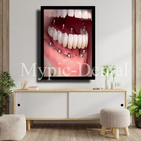TABLEAU DÉCORATIF MODERNE POUR UN CABINET DENTAIRE