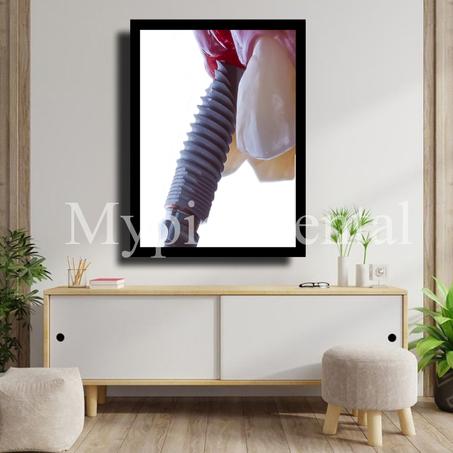 TABLEAU DÉCORATIF MODERNE POUR UN CABINET DENTAIRE