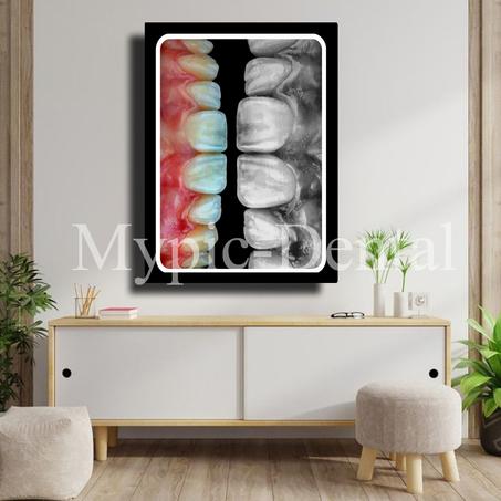 TABLEAU DÉCORATIF MODERNE POUR UN CABINET DENTAIRE