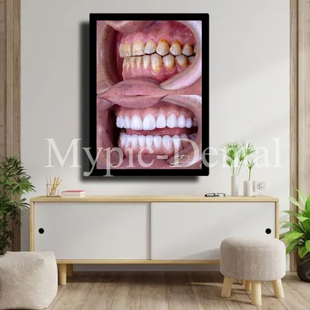 TABLEAU DÉCORATIF MODERNE POUR UN CABINET DENTAIRE