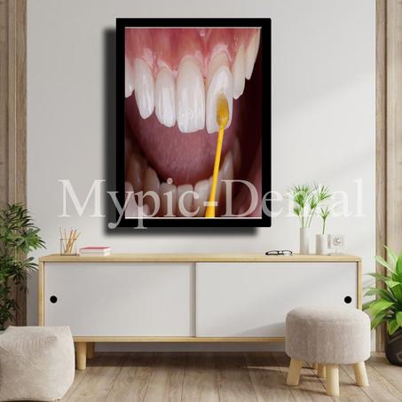 TABLEAU DÉCORATIF MODERNE POUR UN CABINET DENTAIRE