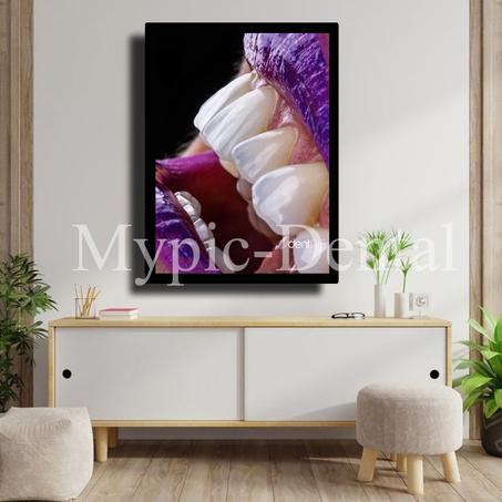 TABLEAU DÉCORATIF MODERNE POUR UN CABINET DENTAIRE