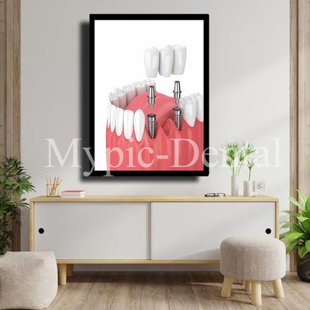 TABLEAU DÉCORATIF MODERNE POUR UN CABINET DENTAIRE