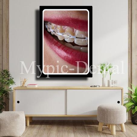 TABLEAU DÉCORATIF MODERNE POUR UN CABINET DENTAIRE