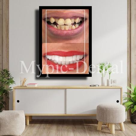 TABLEAU DÉCORATIF MODERNE POUR UN CABINET DENTAIRE