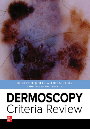 Dermoscopy Criteria Review PDF 