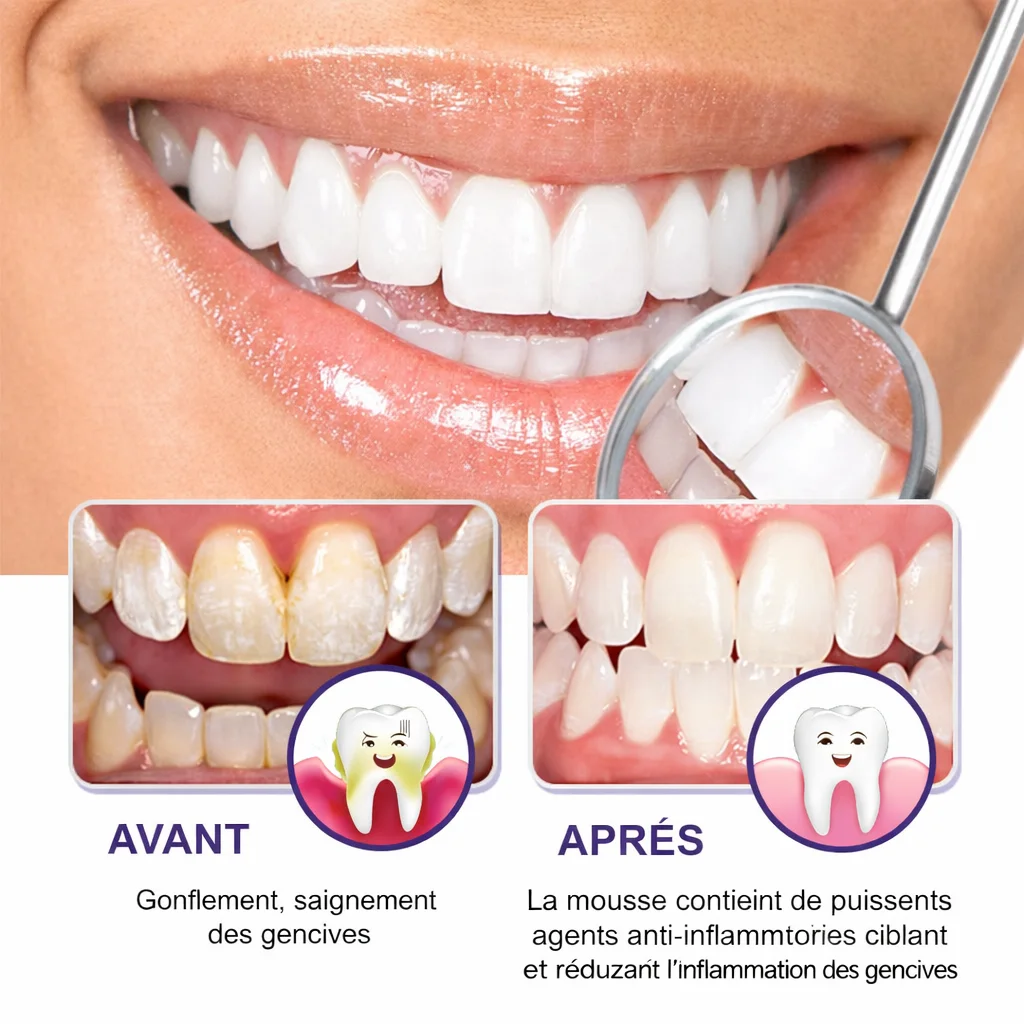 🦷 Toothache Spray – Soulagement rapide contre le mal de dents