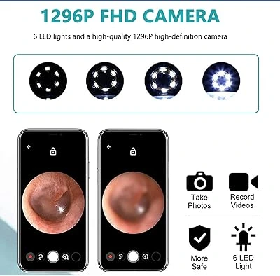 منظّف شمع الأذن بكاميرا  (منظار أذن ذكي) اتصال بلوتوث  + رؤوس سيليكون