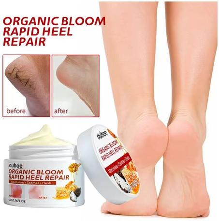 كريم طبيعي للتشققات وجفاف القدمين