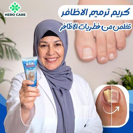 كريم علاج فطريات الأظافر