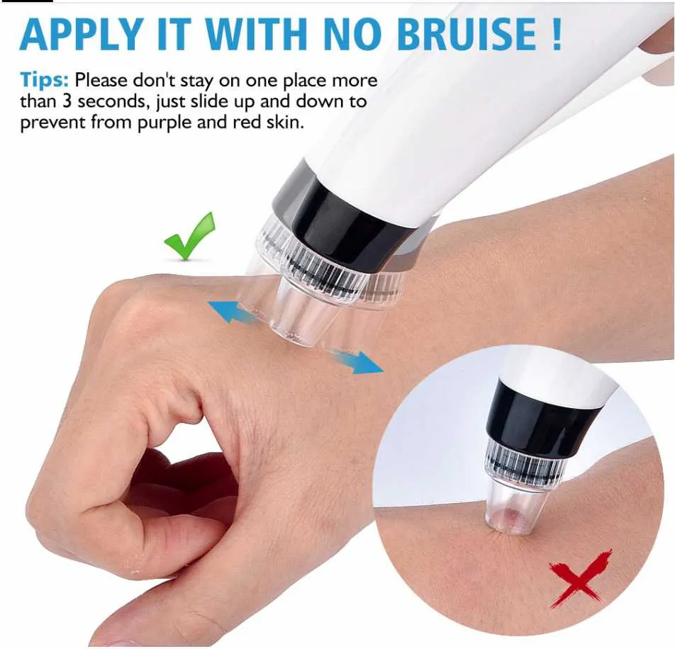 مزيل الرؤوس السوداء