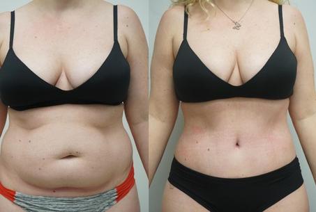 Herbal Gel Manceur du corps  كريم للقضاء على الدهون من الجسم