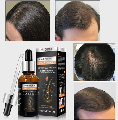 زيت Hair Growth