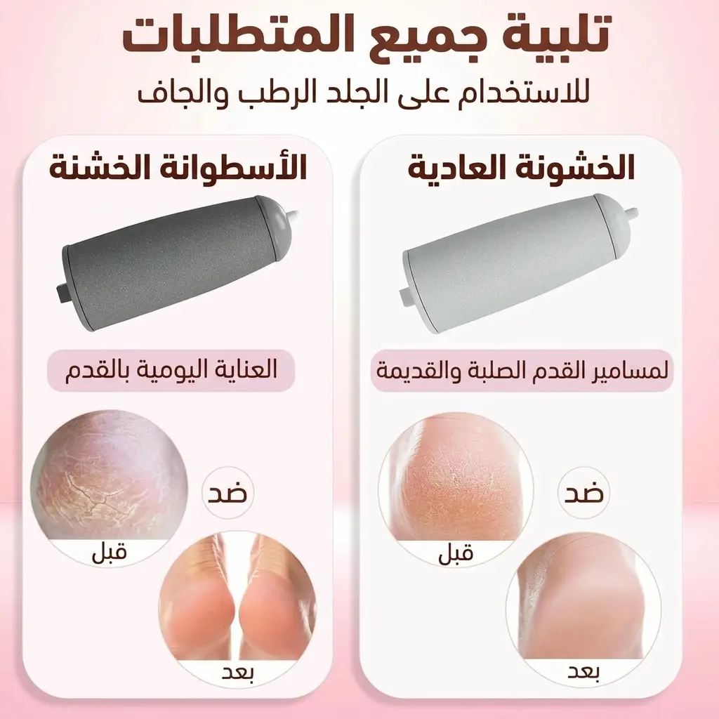 مقشر القدمين الكهربائي