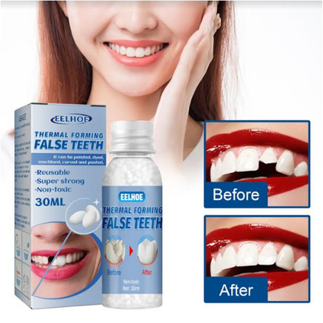 PERFECT SMILE™ حبيبات إصلاح الأسنان