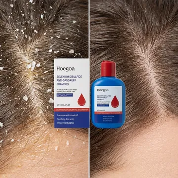 عرض 3شامبو ثنائي كبريتيد السيلينيوم لتنظيف فروة الرأس بعمق