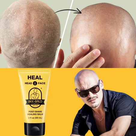 جل Bee Bald HEAD   لعالج إحمرار وتهيج البشرة بعد حلاقة الرأس