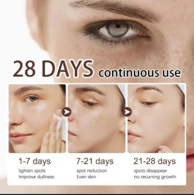 Face Peeling Mask