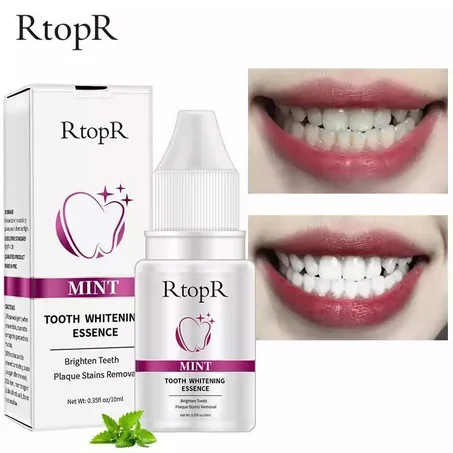 كريم لتبيض الأسنان