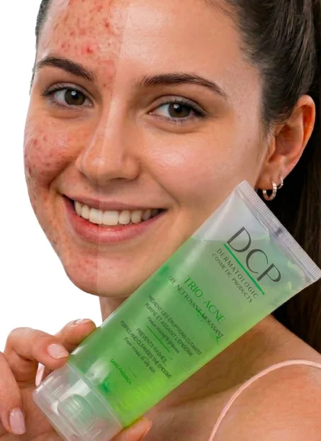 Gel nettoyant anti acné