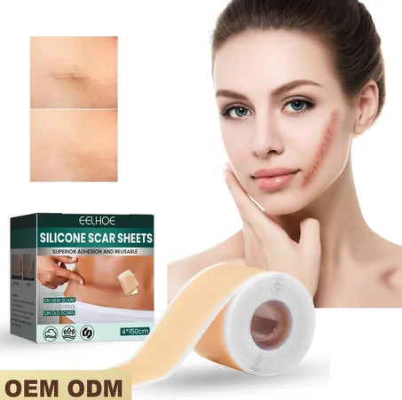 Silicone scar sheets