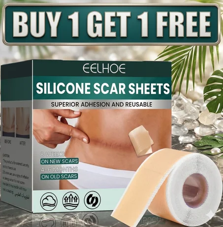 Silicon scar sheets (BUY 1 GET 1 FREE)