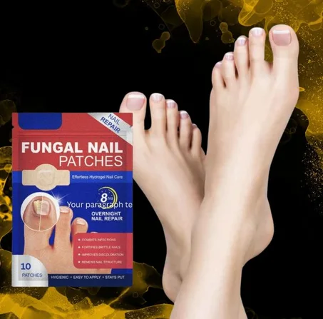 علاج الأظافر الفطرية: لصقات هيدروجيلية