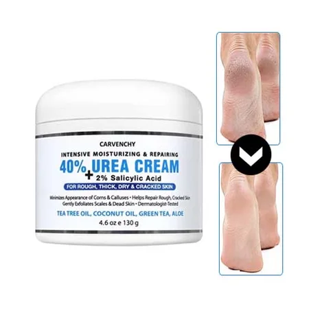 كريم اليوريا 40%  للقدم والكعوب الجافة المتشققة والركبتين والمرفقين