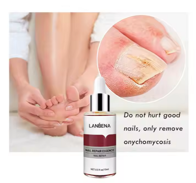 stores/c4a44b265381f8a451c2f6625f0e8fb1/products/PJP1IQCsdSyhiYEzljc9kXfbVvTNDsVCp3ITOfPV.png