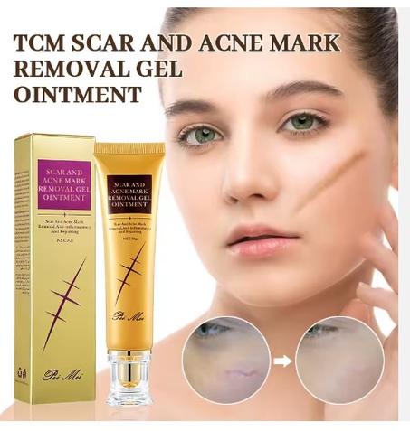 TCM Scar & Acne Mark Removal Gel Ointment