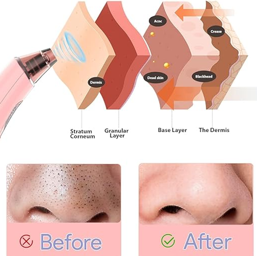 Blackhead Vacuum, Facial Cleanser