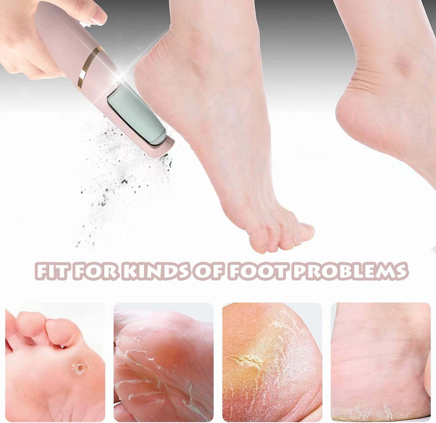 Rechargeable electric foot file and massager with removable design, removes calluses and dead skin