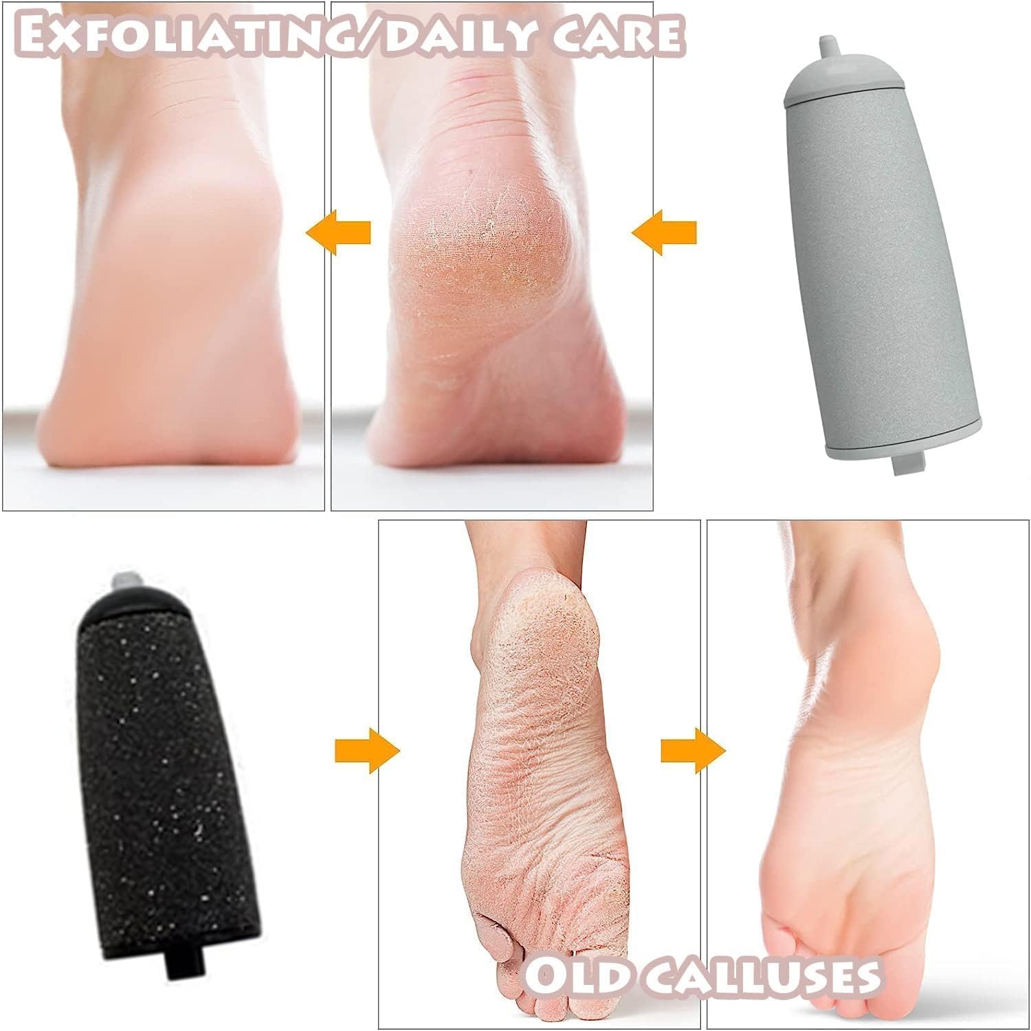 Rechargeable electric foot file and massager with removable design, removes calluses and dead skin
