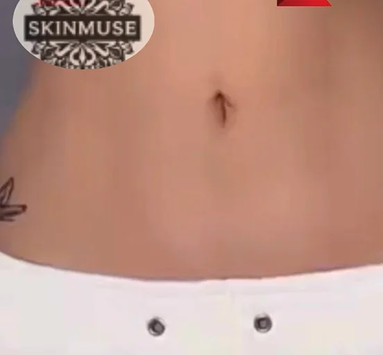 حزام شد البطن 5 أمتار القابل للتعديل | خصر مشدود ومظهر أنيق فوراً