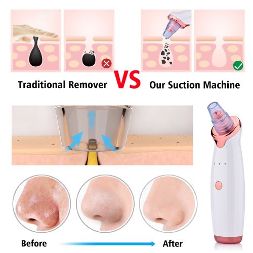 Blackhead Vacuum, Facial Cleanser