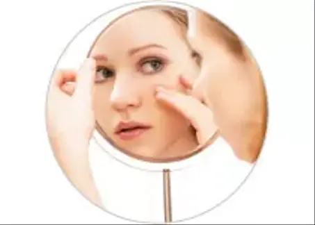 Acné & Imperfections-حب الشباب والعيوب