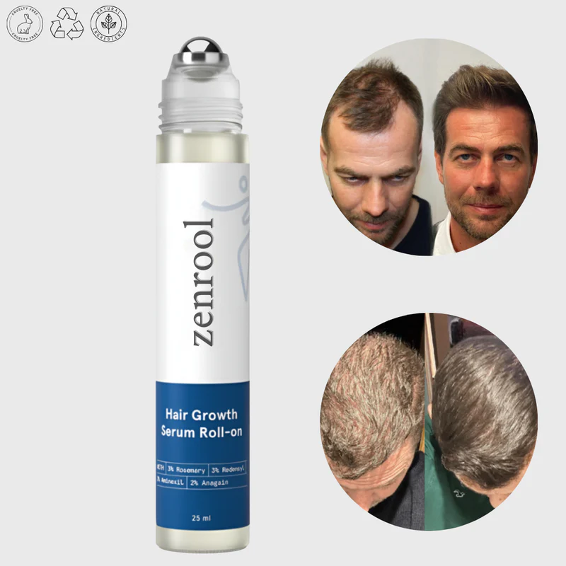 Sérum de Croissance des Cheveux Zenitol