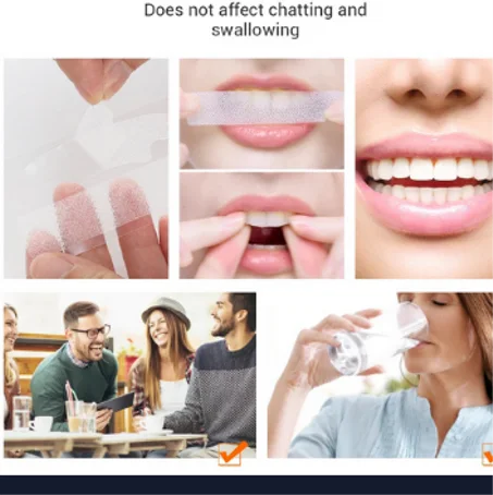 شرائط تبييض الأسنان