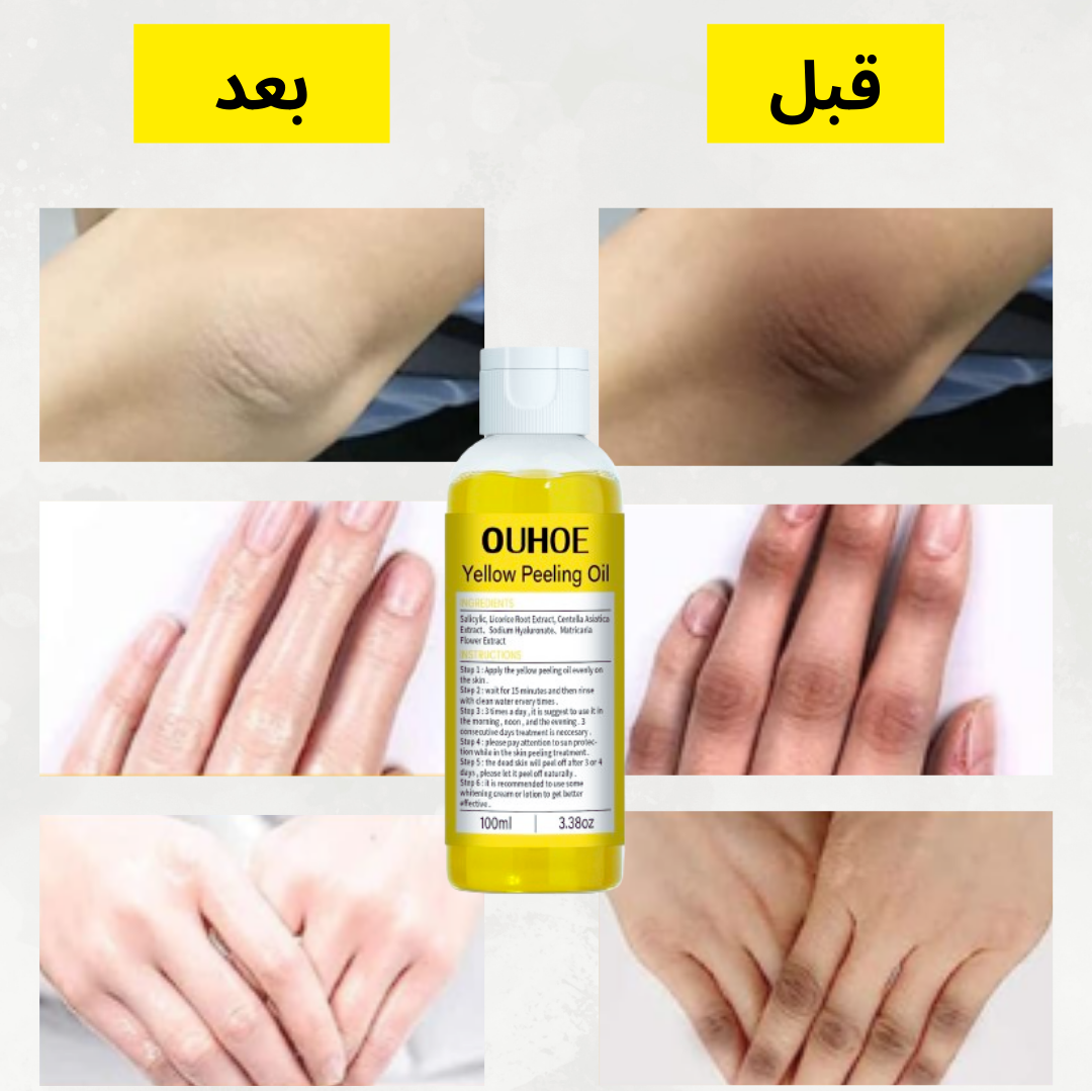 زيت التقشير الأصفر   OUHOE - تقشير، تفتيح و ترطيب البشرة