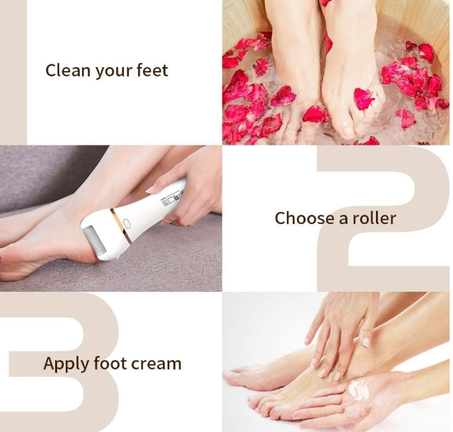 مزيل الكالو الكهربائي