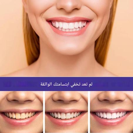 معجون منعش لتبييض الأسنان الطبيعية Eelhoe v34🟡🦷🟣