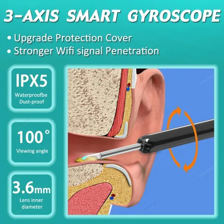 Nettoyeur d'oreille sans fil avec caméra HD