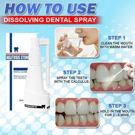 Vaporisateur oral puissant dissolvant le tartre ShinTeet