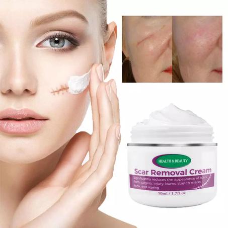 الكريم السحري لازالة الندبات  Magic scar removal cream