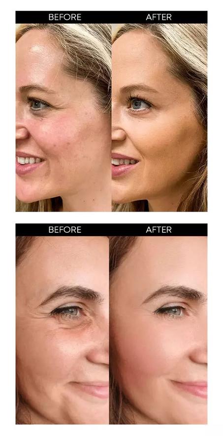 مجموعة مصل الوجه بالكولاجين  Collagen Face Serum Set - KSA