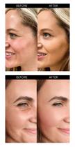 stores/c780fa02026a94cafdcff3b9188f20be/products/ytQWidASTl6wVec3CFoIwAIP8FHknTGmoh1PSoRu.jpg