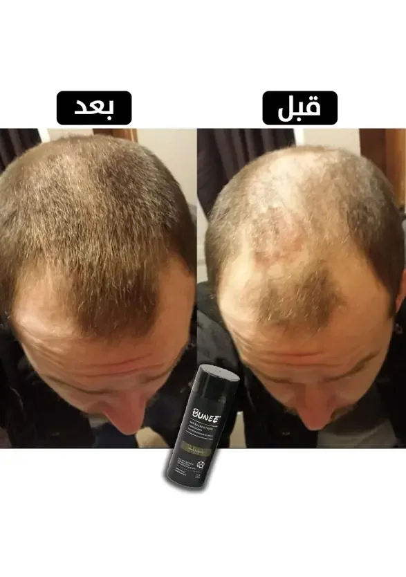 BUNEE ألياف ملأ فراغات الشعر
