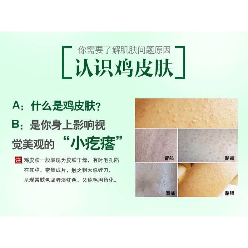 stores/c7f03f5093dbd776d4d28dde5663bb59/products/NYZV4afB2v67ziwWbUtembeQjXyoTKwiK1Uw0IZH.jpg