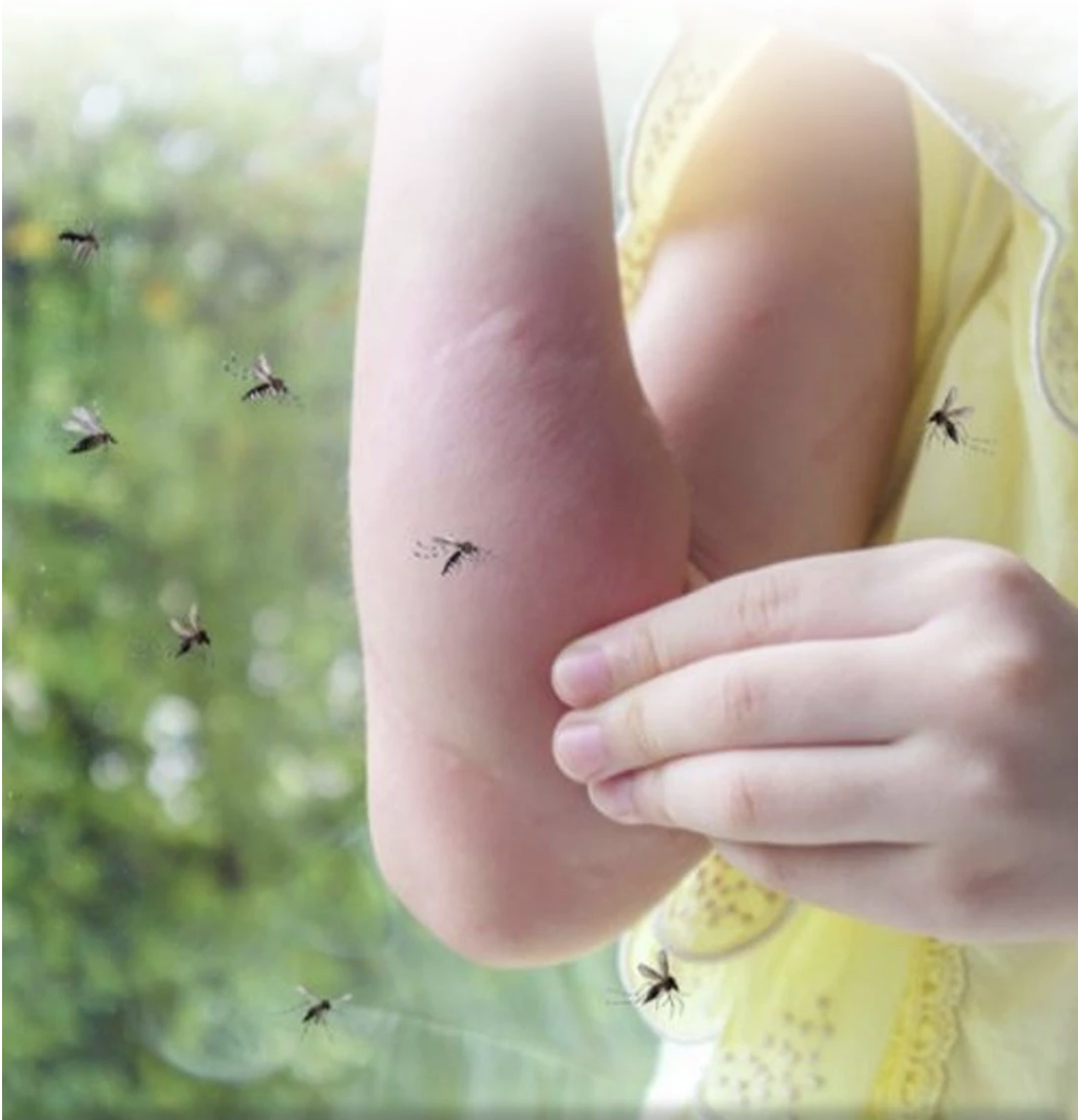 سوار طارد للبعوض بالموجات فوق الصوتية