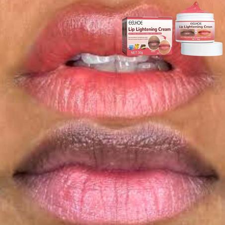 توريد و تفتيح الشفايف